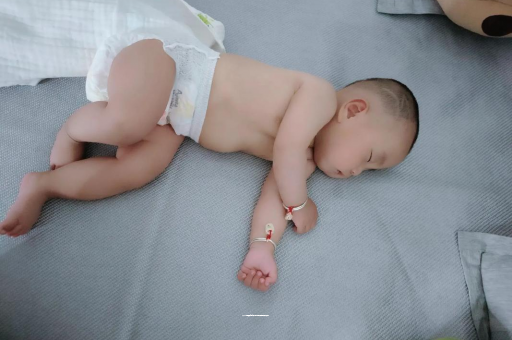 聊城六个月宝宝眼睛散光